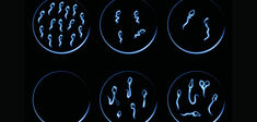 Le spermatozoïde, patient malade de la reproduction ? La chronique d’Anne-Sophie Moreau